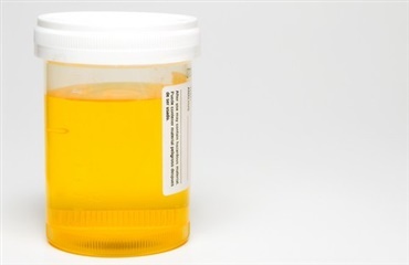 Hunde kan finde kræft via urinprøver